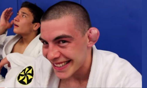 cauliflower ear bjj